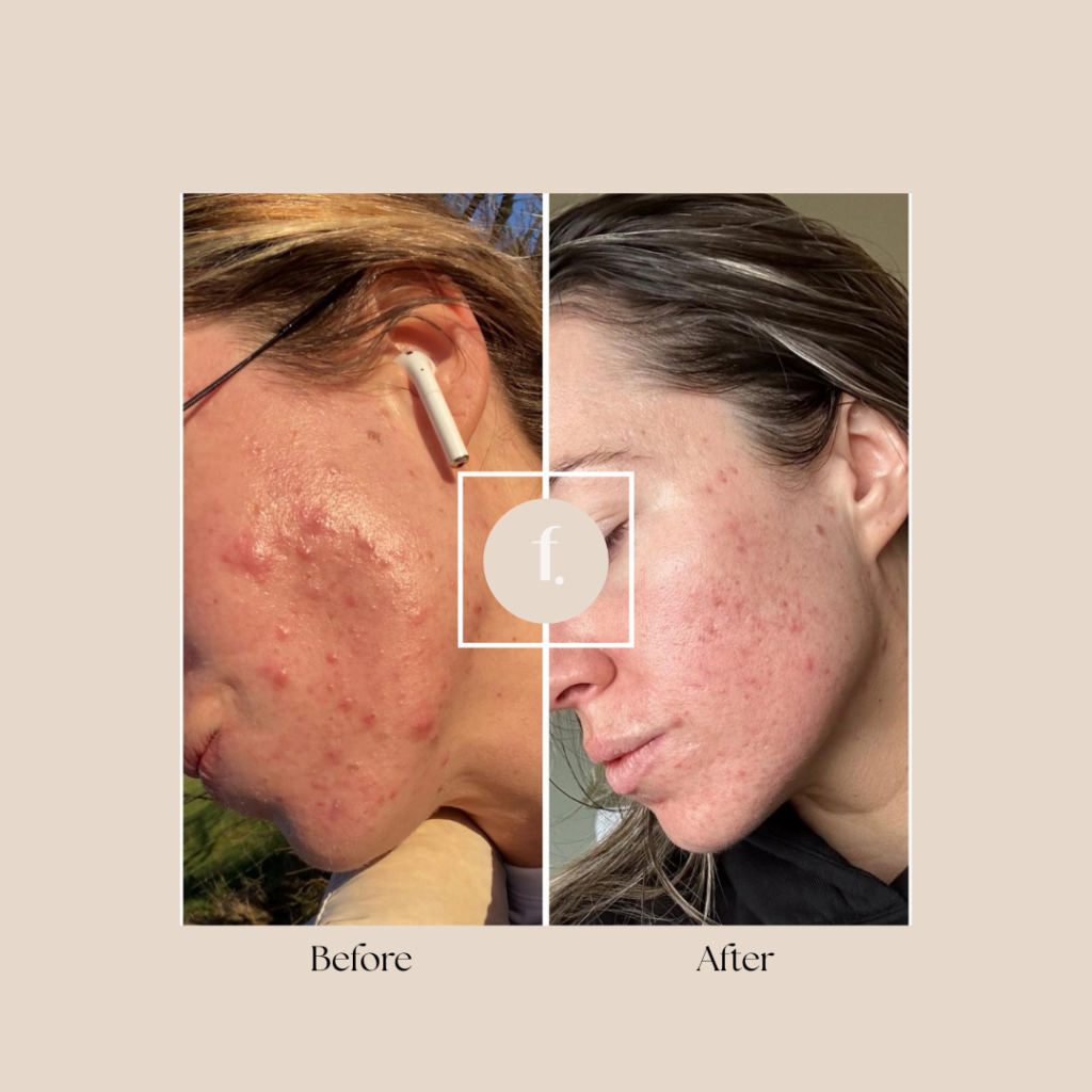 Bloated, tired or feeling hormonal? Freya Clinic’s Ultimate Gut and Hormone Reset Package could be the answer