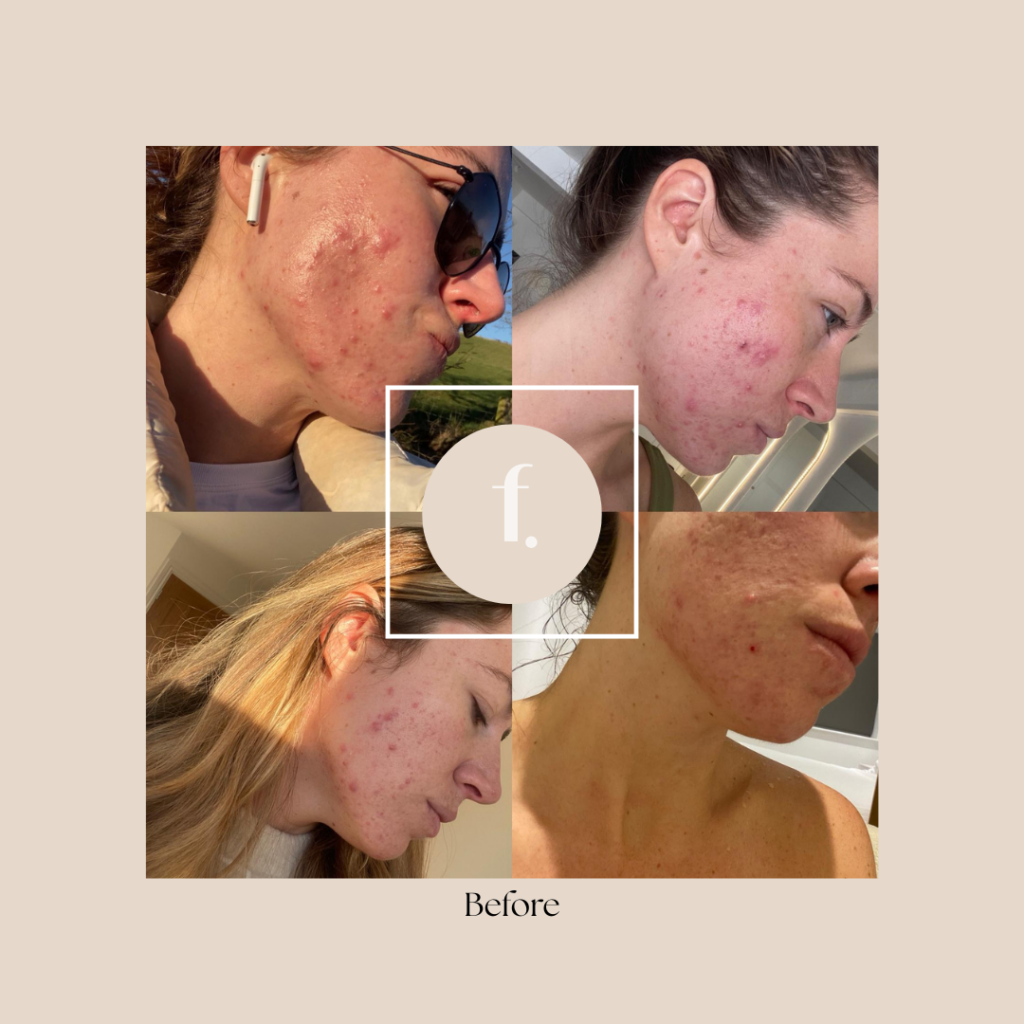 Bloated, tired or feeling hormonal? Freya Clinic’s Ultimate Gut and Hormone Reset Package could be the answer