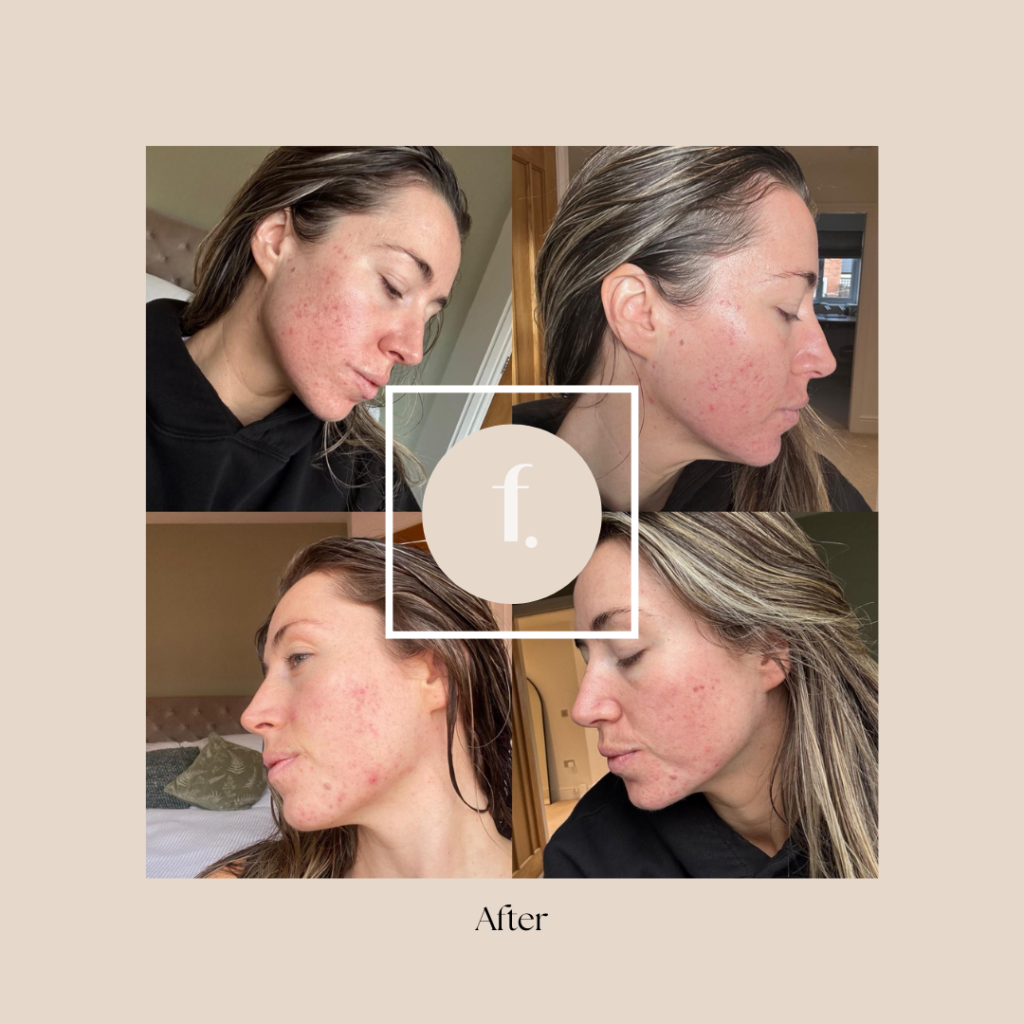 Bloated, tired or feeling hormonal? Freya Clinic’s Ultimate Gut and Hormone Reset Package could be the answer